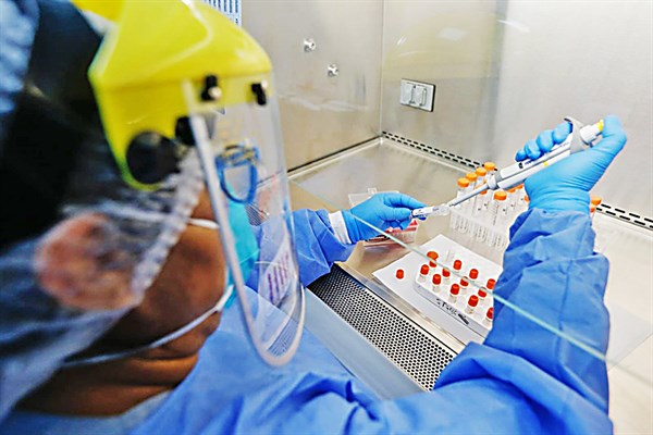 Coronavirus: Prueba molecular peruana a punto de salir al mercado