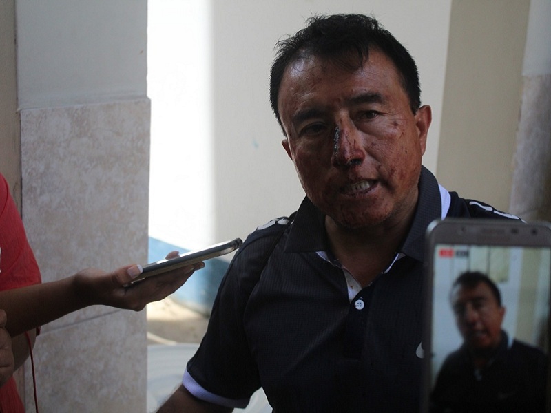 Periodista sufre brutal golpiza por supuesto invasor de Chinecas